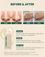 K-Secret Seoul 1988 Cleansing Oil Pine Cica 1% + Probotics 150ml - Image 3