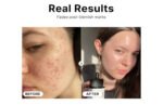 COSRX Niacinamide 15% Face Serum, Minimizing Pores & Sebums, Blemish for Discoloration, Dark Spots, Enlarged Pores, Anti-aging, 20 ml, - Image 5