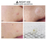 FOCALLURE - Acne Pimple Patch-Day & Night - Image 5