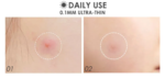 FOCALLURE - Acne Pimple Patch-Day & Night - Image 6